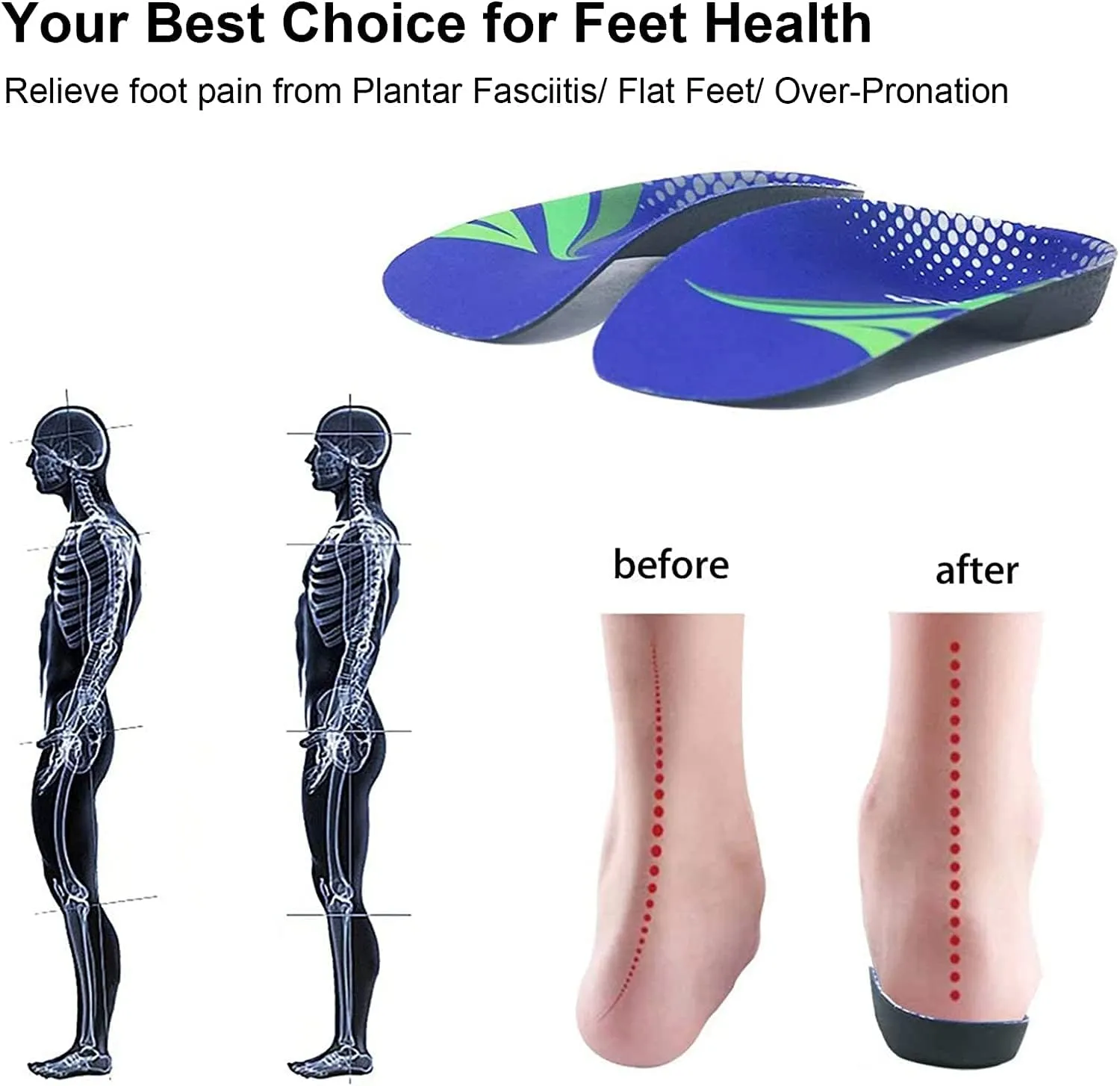 RooRuns FitFeet Orthotic Inserts 3/4 Length, High Arch Support Foot Insoles for Over-Pronation, Plantar Fasciitis, Flat Feet - Shoe Inserts for Walking, Running Men and Women